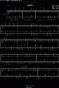 《最后一夜》-指法篇-钢琴谱(钢琴曲