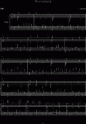 即兴曲(Impromptu)-Concerto