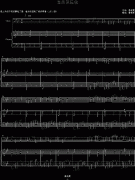 意外的思念(大提与钢琴）-钢琴谱(钢琴曲)-鲁晓夏