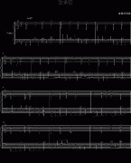 欢乐颂-(简易右手6度练习歌)-贝多芬