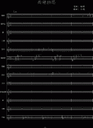 中国风【西湖相思】-钢琴谱(钢琴曲