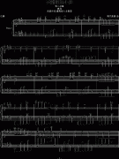 天鹅湖的小船第二乐章（夜曲）-清代皇帝