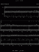 屋顶上的猫-钢琴谱(钢琴曲)-3028102